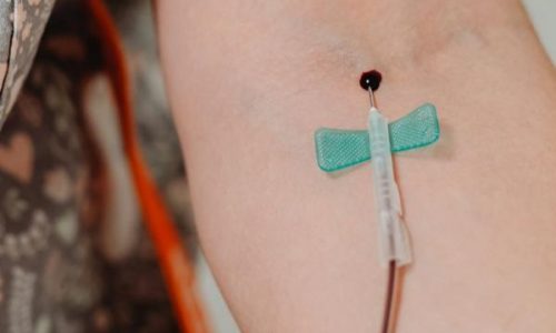 TJRN - Justiça determina que plano de saúde custeie implante de cateter para hemodiálise em criança